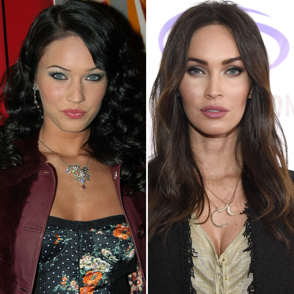 Megan fox plastic surgery
