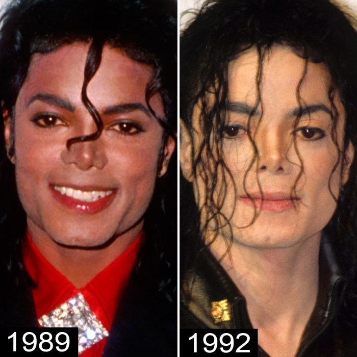 Michael Jackson s Plastic Surgery See His Transformation michael-jackson-s-plastic-surgery-see-his-transformation