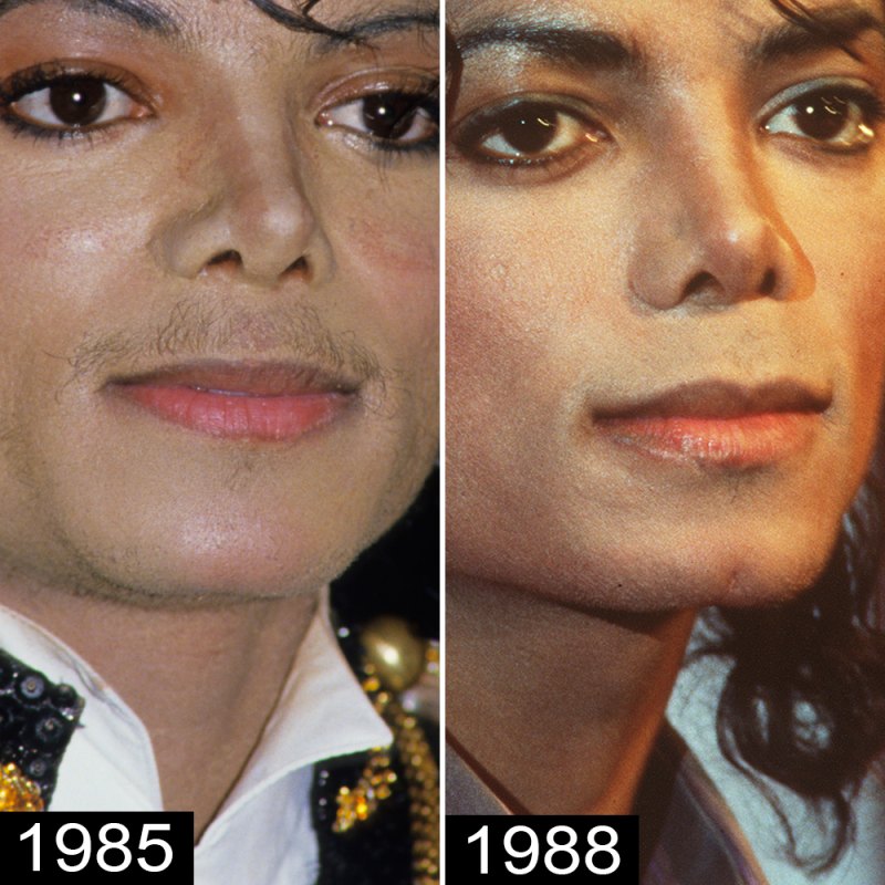 Revisor tidligste legemliggøre Michael Jackson's Plastic Surgery — See His Transformation