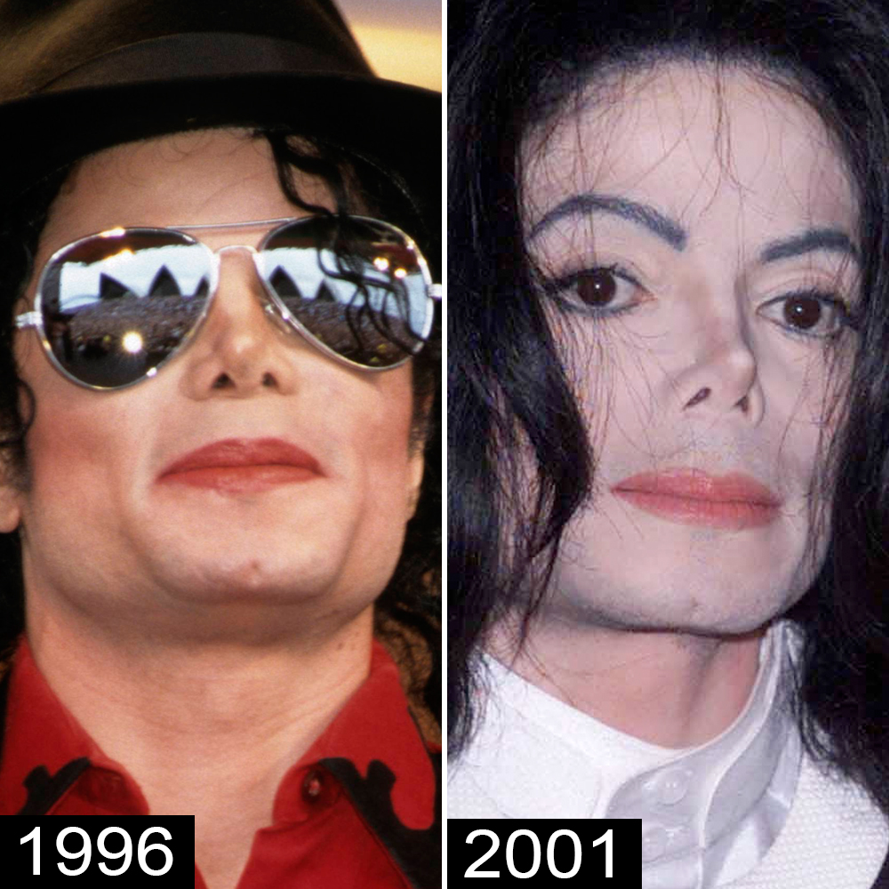 Michael Jackson s Plastic Surgery See His Transformation michael-jackson-s-plastic-surgery-see-his-transformation
