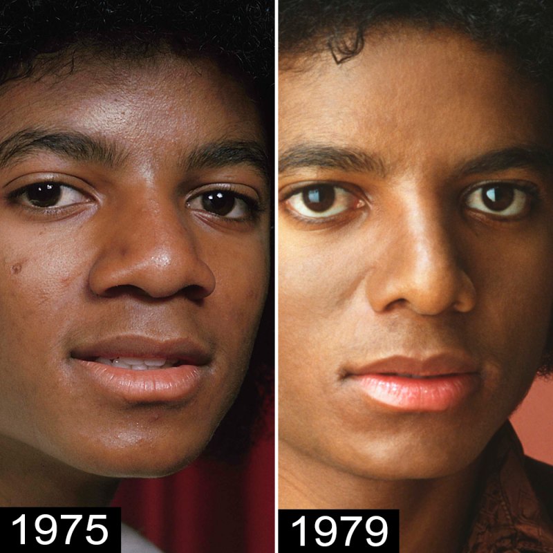 Michael Jackson's Plastic Surgery — See His Transformation