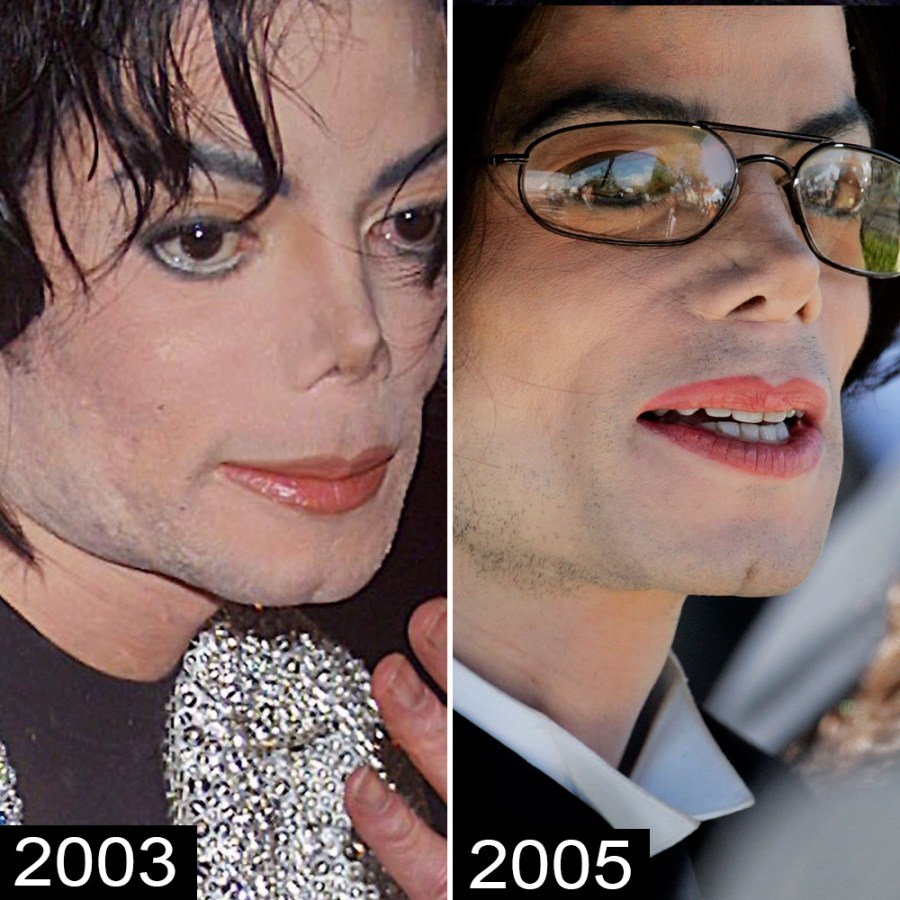 Michael Jackson s Plastic Surgery See His Transformation michael-jackson-s-plastic-surgery-see-his-transformation