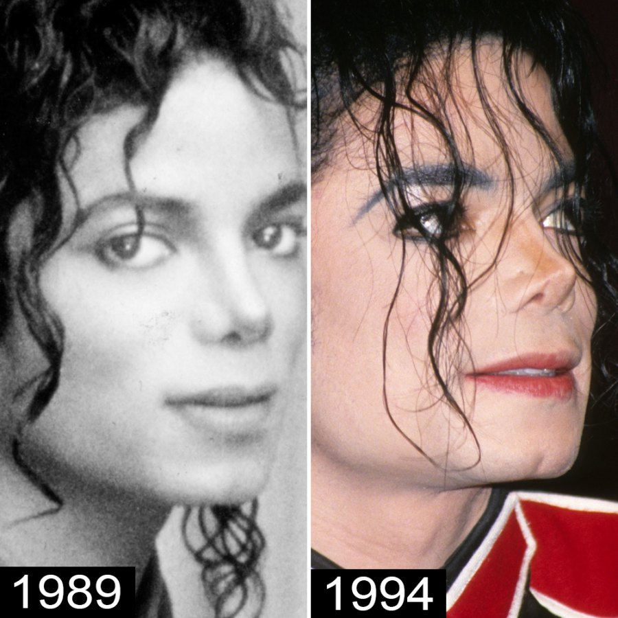Michael Jackson s Plastic Surgery See His Transformation Life Style michael-jackson-s-plastic-surgery-see-his-transformation-life-style