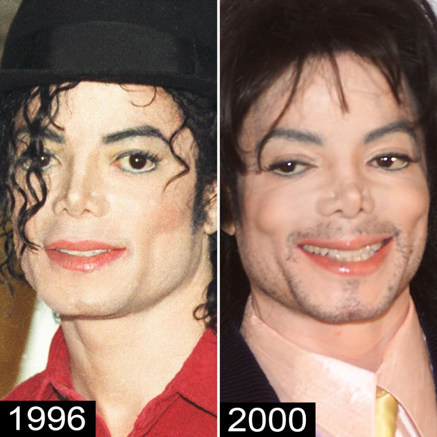 Michael Jackson s Plastic Surgery See His Transformation michael-jackson-s-plastic-surgery-see-his-transformation