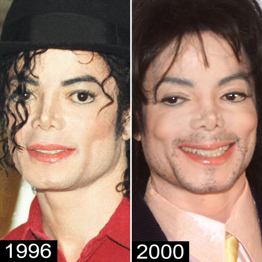Michael Jackson s Plastic Surgery See His Transformation Life Style michael-jackson-s-plastic-surgery-see-his-transformation-life-style
