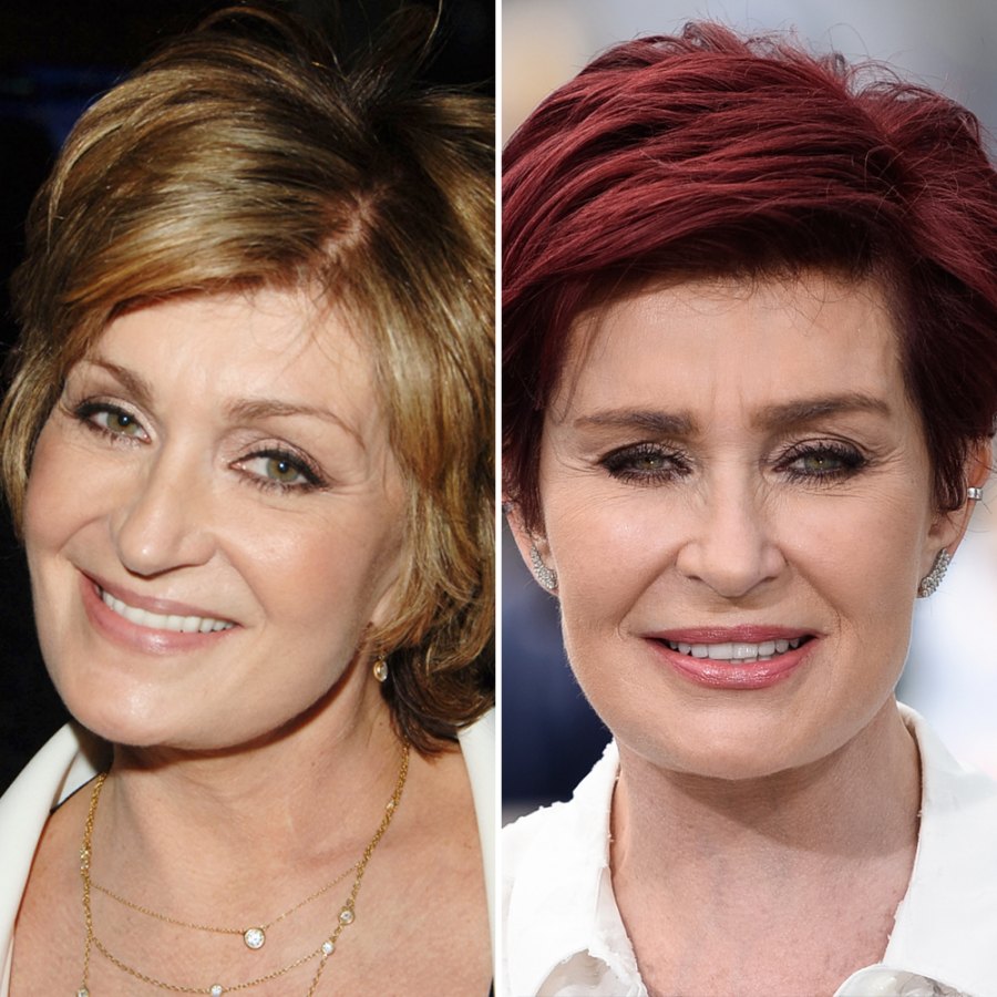 Celebrity Facelifts And Plastic Surgery See Then and Now Pics Life Celebrity Facelifts And Plastic Surgery See Then and Now Pics Life