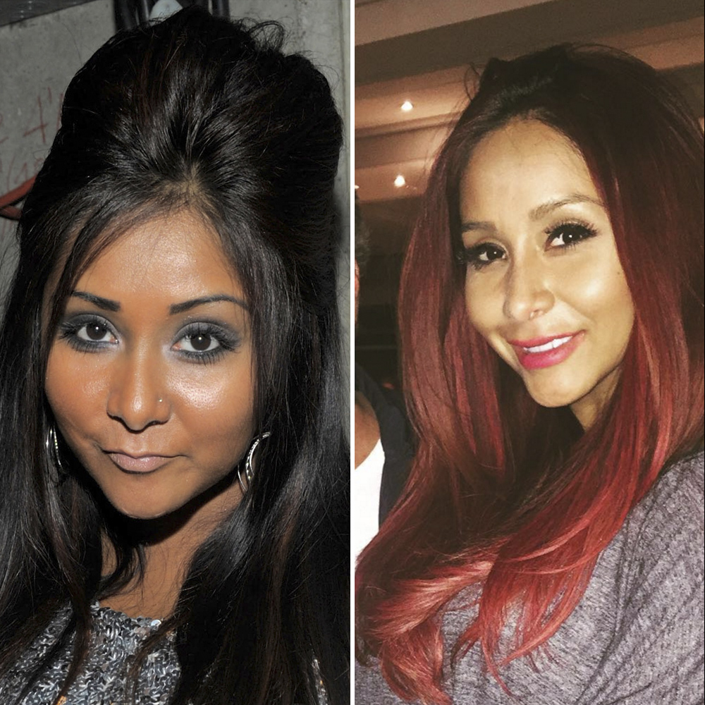 Snooki plastic surgery