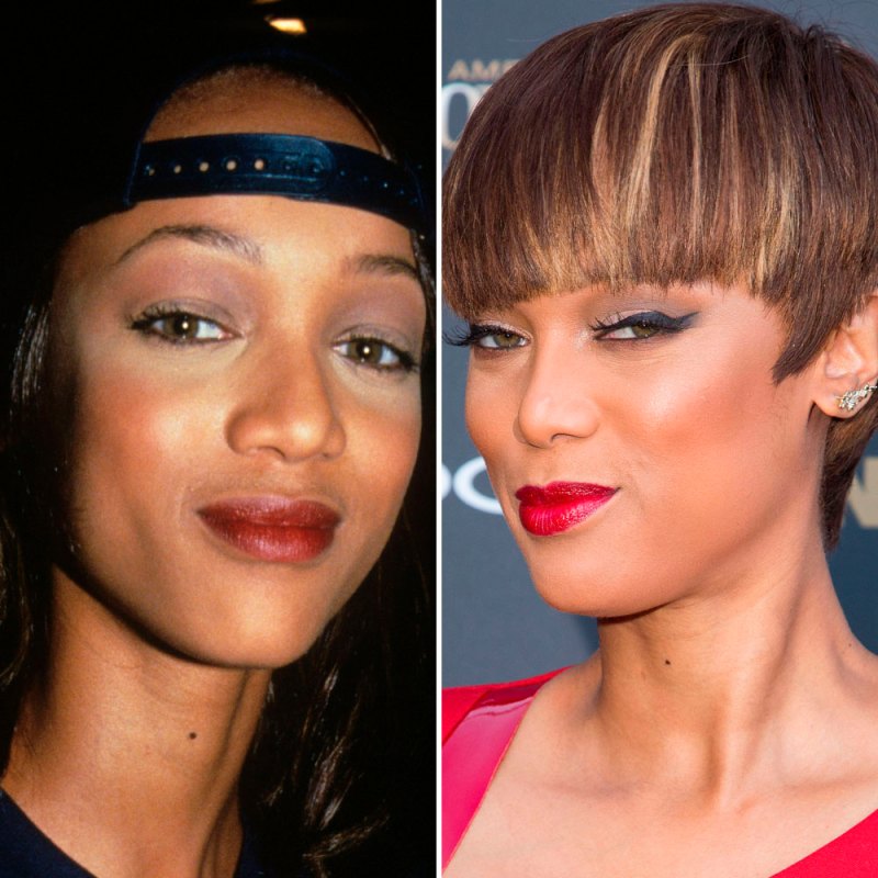Tyra banks plastic surgery