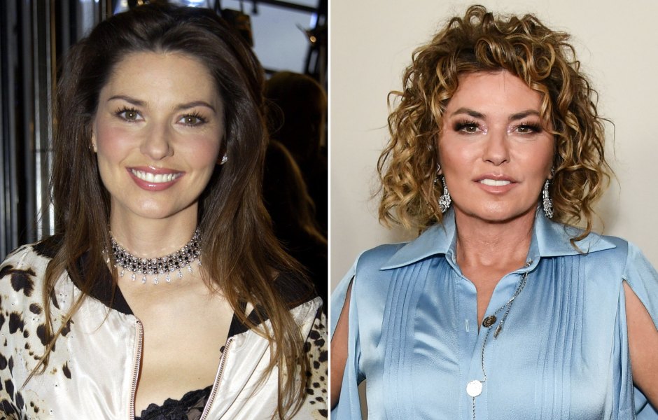 Shania Twain Plastic Surgery — Did the Country Star Go Under the Knife?