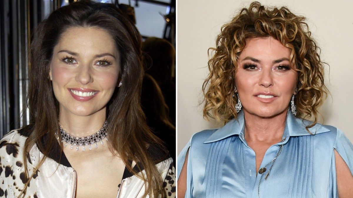 Shania Twain Plastic Surgery: Did the Country Star Go Under the Knife?