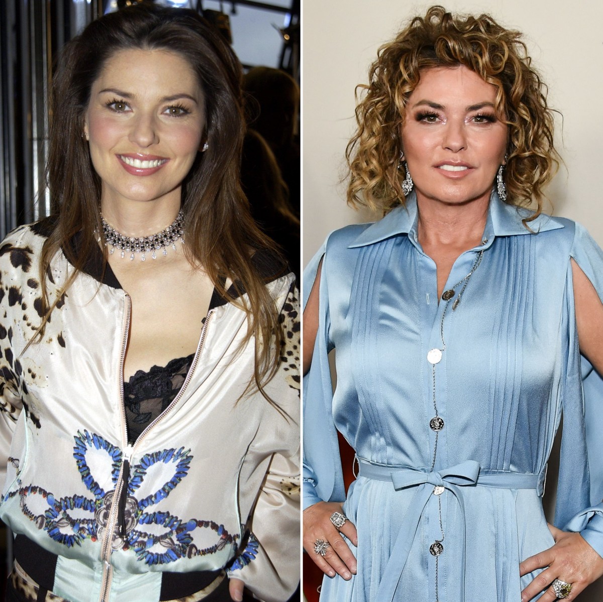 Shania Twain Plastic Surgery Did the Country Star Go Under the Knife?