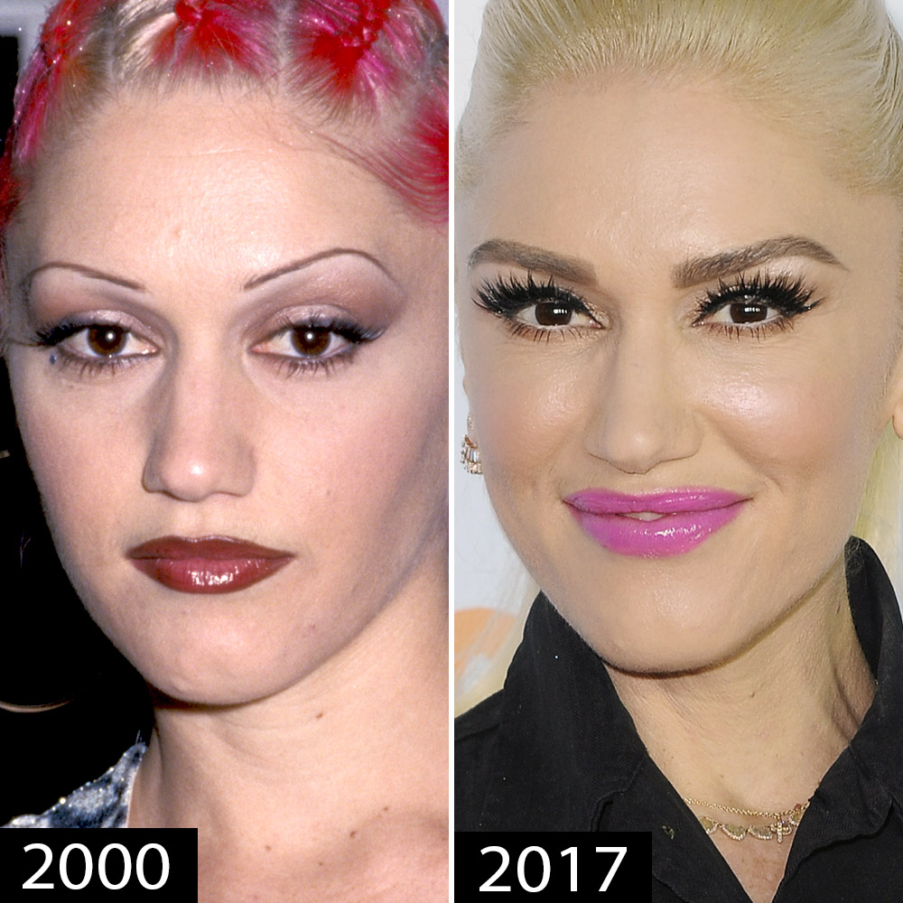 Celebrity Eyebrow Transformations
