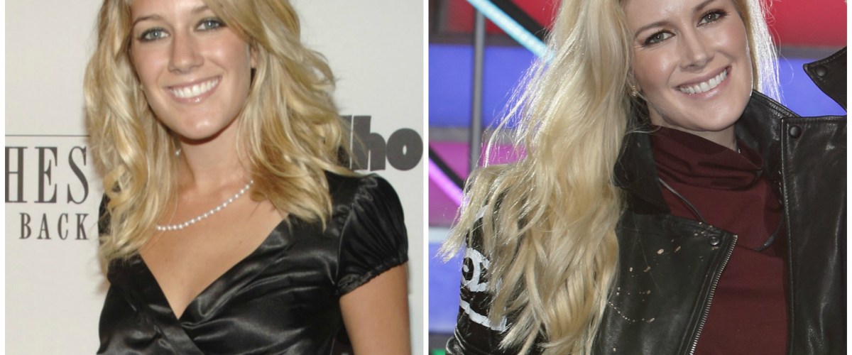 Heidi Montag Before And After Pics See Her Plastic Surgery Transformation Volta