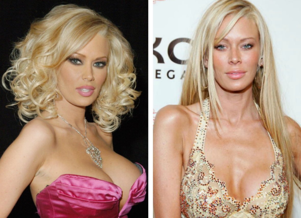 1180px x 857px - See Jenna Jameson Before and After Plastic Surgery!
