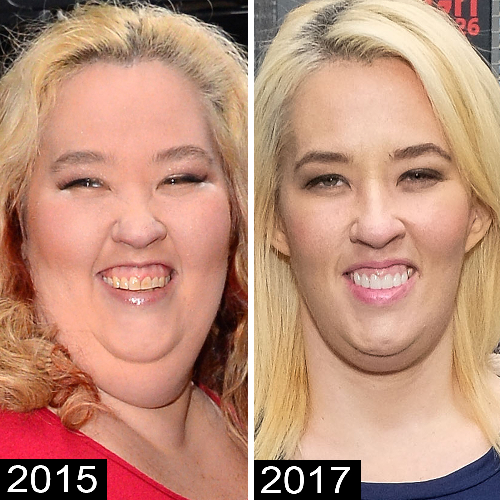Mama june overall face