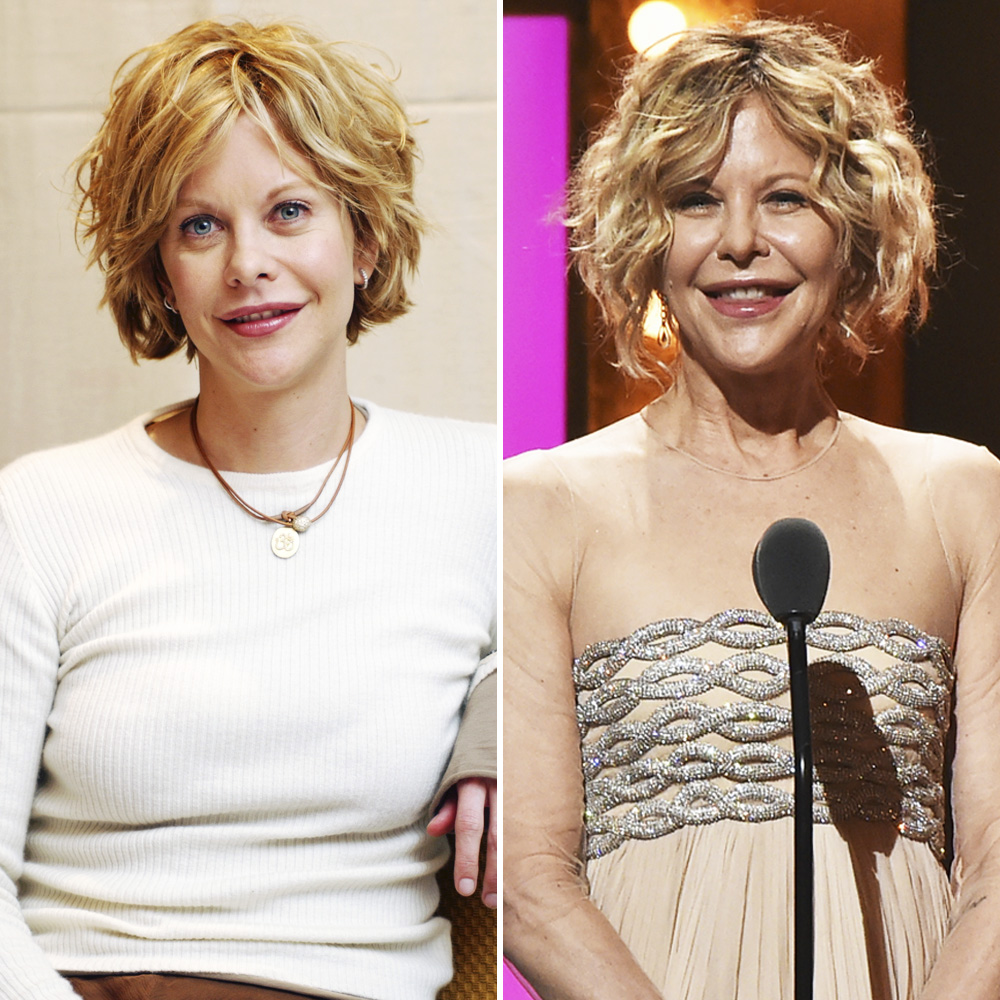 See Meg Ryan'S Rumored Plastic Surgery Pictures!