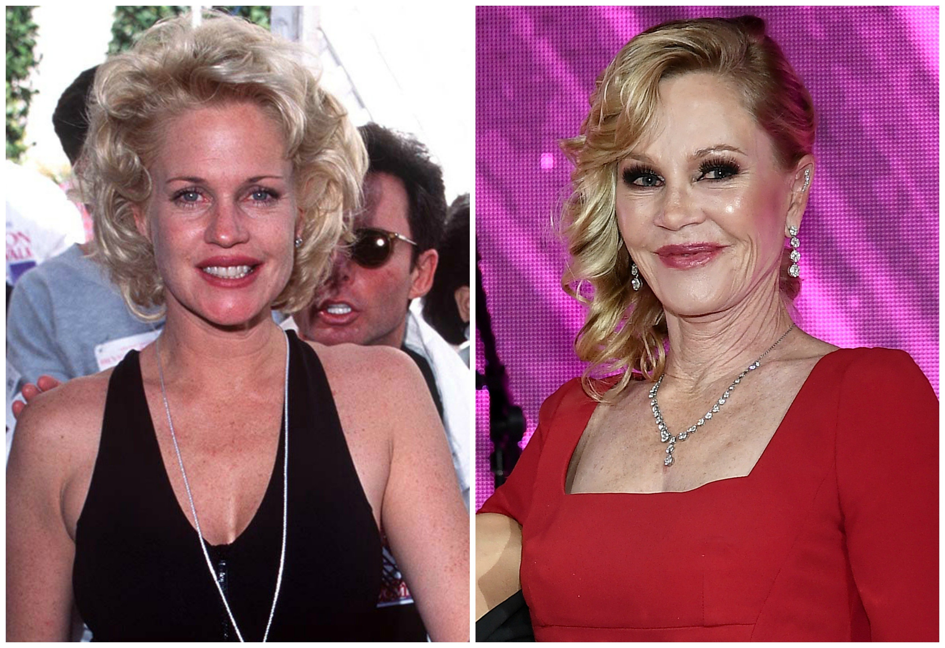 Melanie Griffith's Plastic Surgery Disaster: Find out What Went Wrong ...
