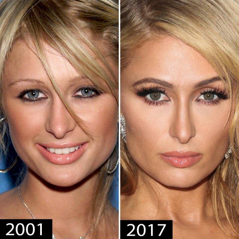 Paris hilton eyebrows transformation