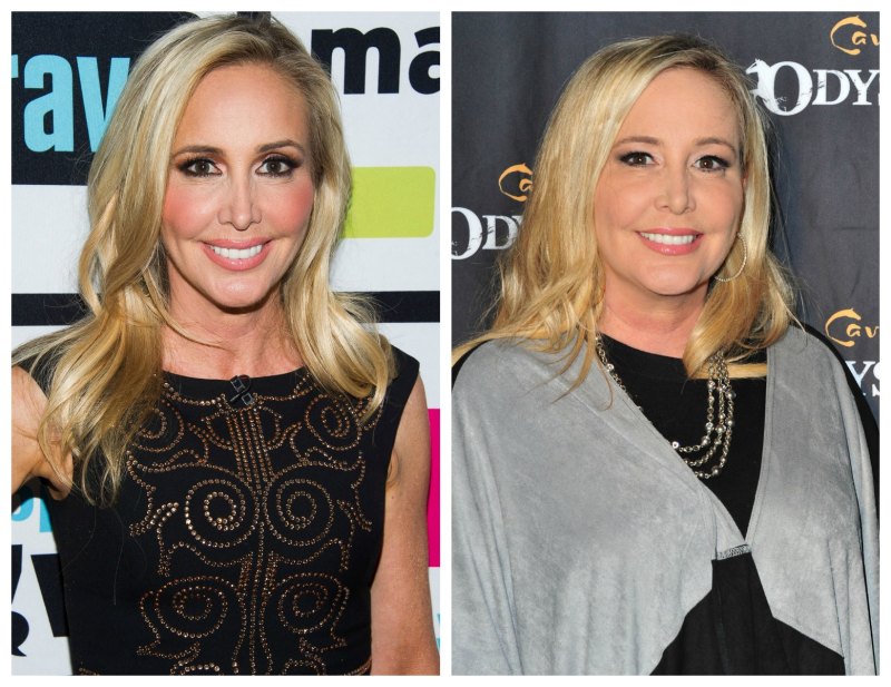Shannon beador plastic surgery 1