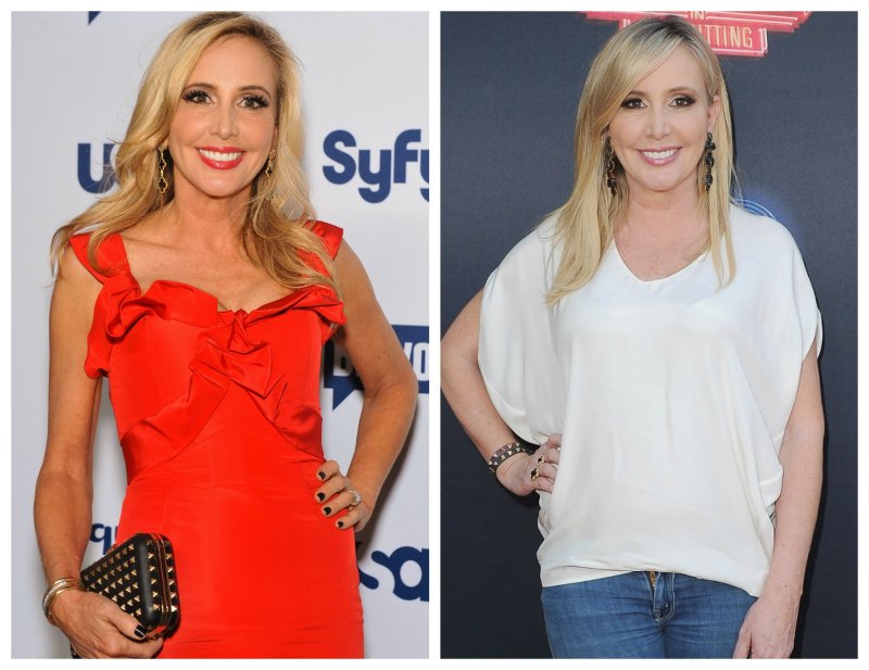 Shannon beador plastic surgery 3