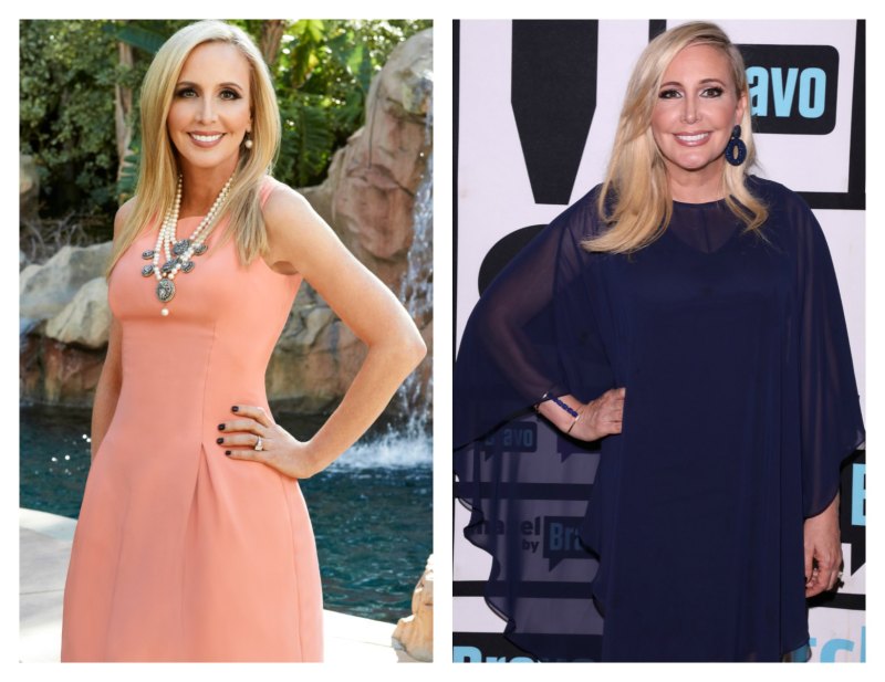 Shannon beador plastic surgery 4
