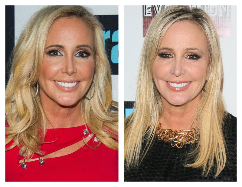 Shannon beador plastic surgery 5