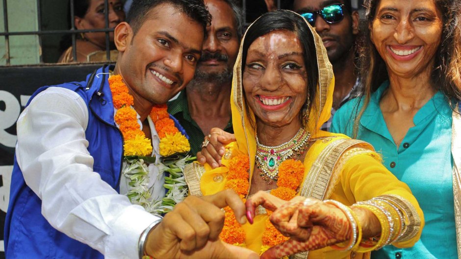 Acid attack survivor marries