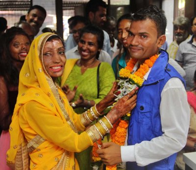 acid attack survivor getty images acid attack survivor getty images