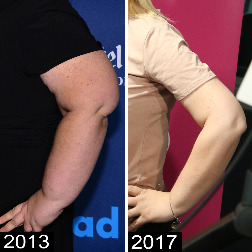 Mama june arms 2