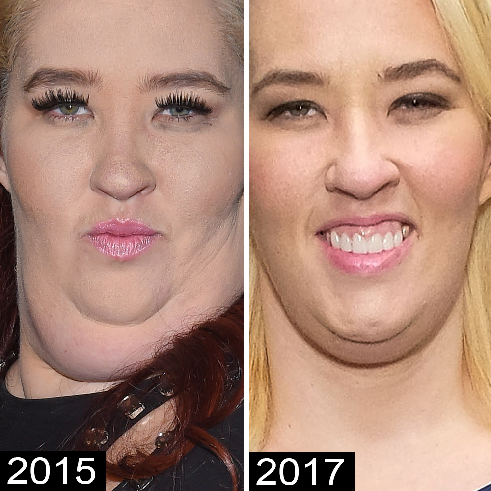 Mama june chin again