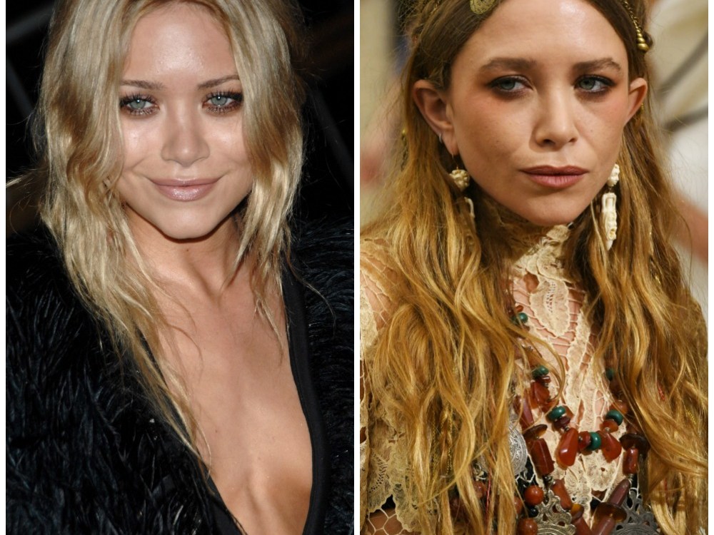Did MaryKate Olsen Get Plastic Surgery? See Before and