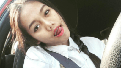 Student scar tattoo removal