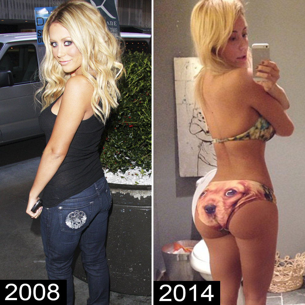 Before-and-After Pics of Celebrities With Rumored Butt Implants photo