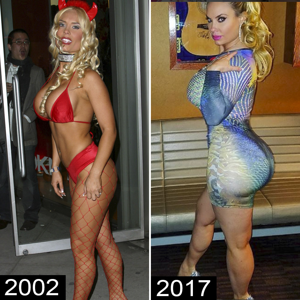 Before-and-After Pics of Celebrities With Rumored Butt Implants image photo