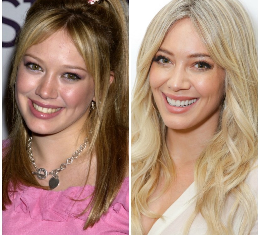 Plastic Surgery? Hilary Duff Reveals Secret to AgeDefying Glow!