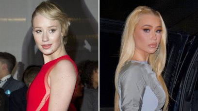 Iggy Azalea Has Been Honest About Plastic Surgery: See Her Before and After Transformation Photos