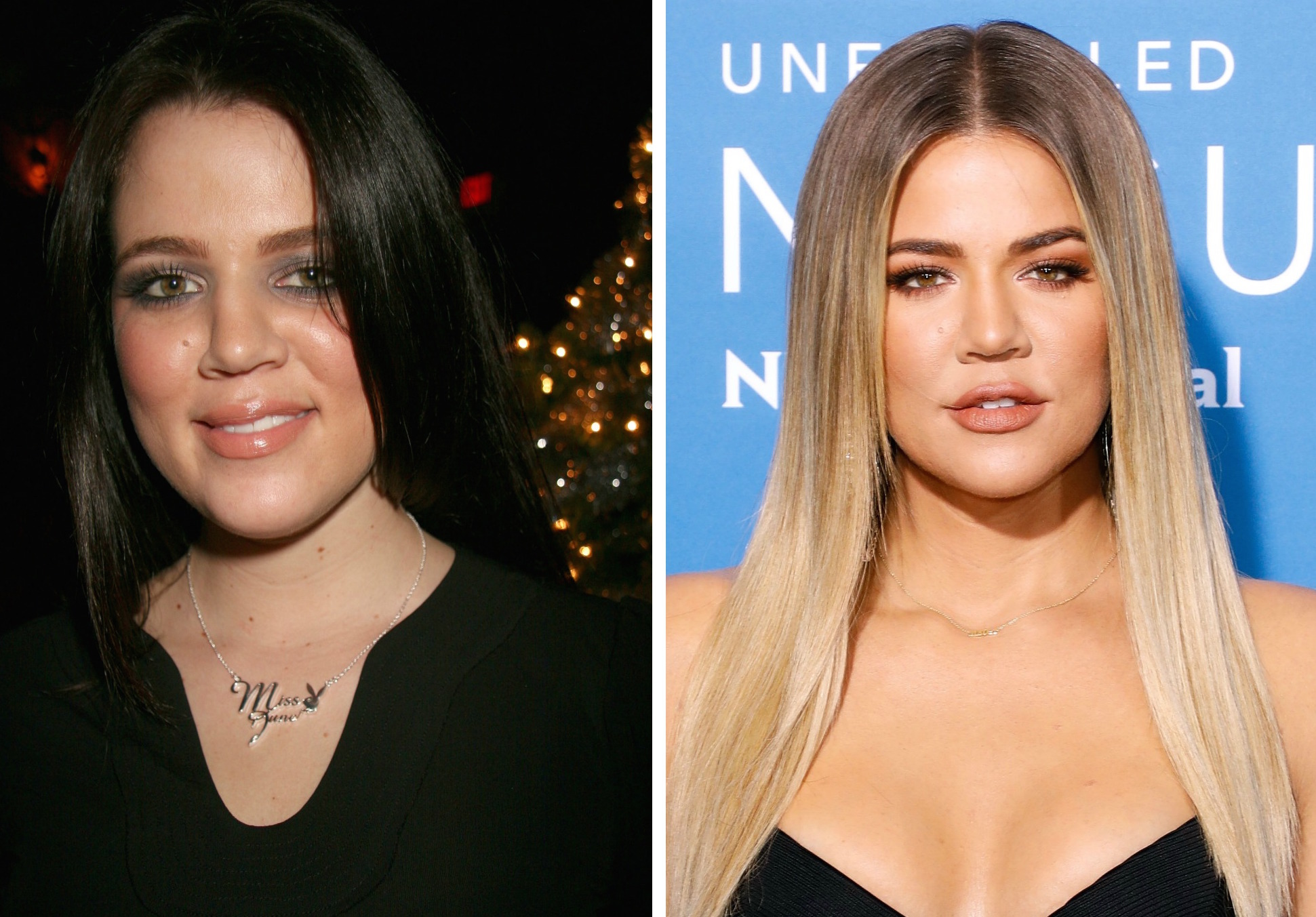 khloe-kardashian-before-and-after-plastic-surgery.jpg
