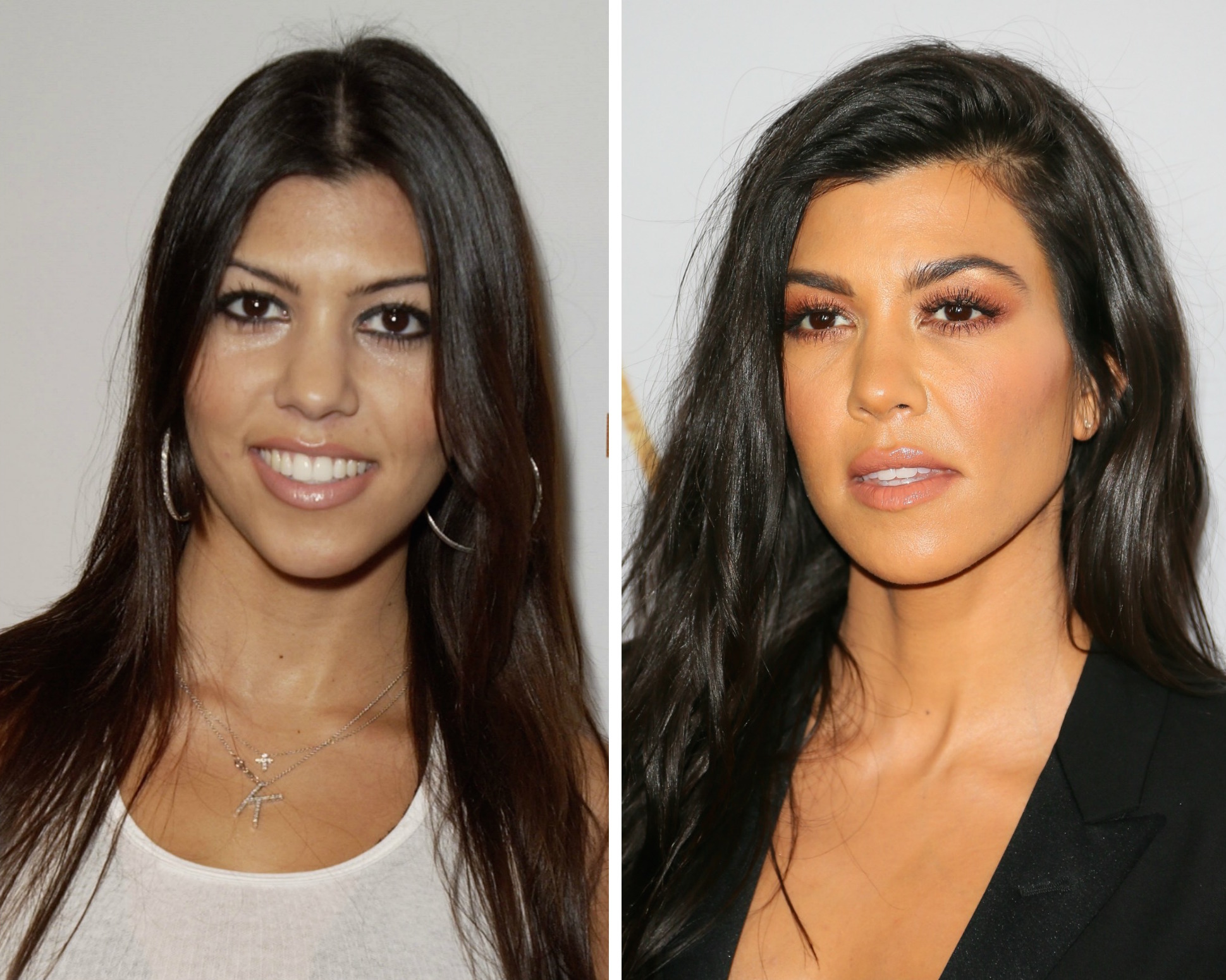 Kourtney kardashian before and after plastic surgery