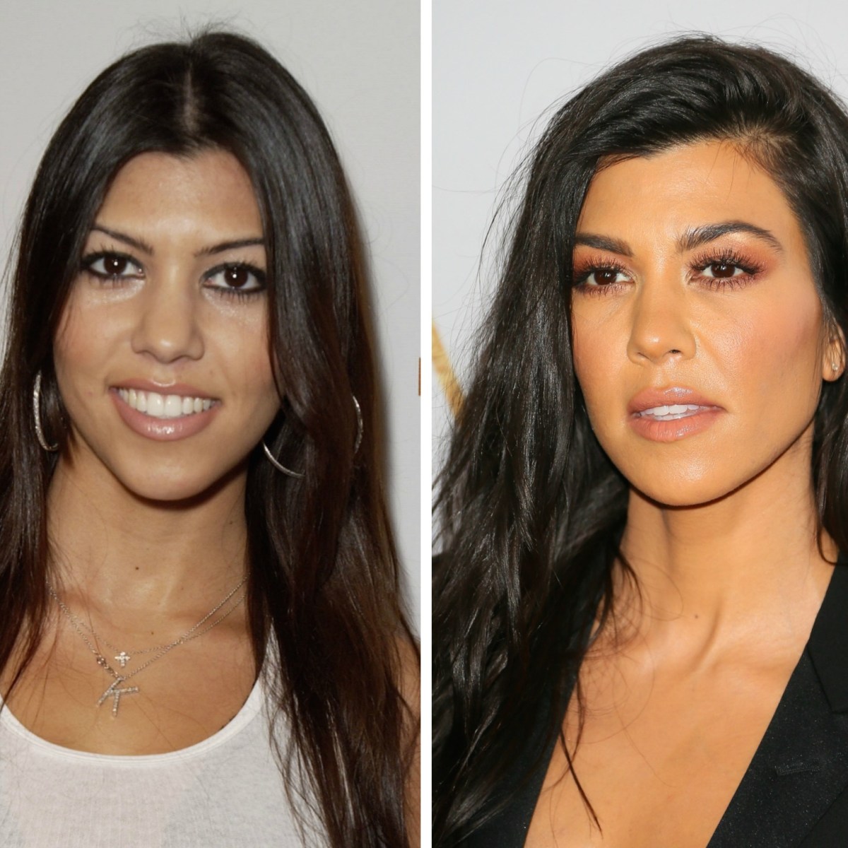 kourtney-kardashian-before-and-after-plastic-surgery.jpg