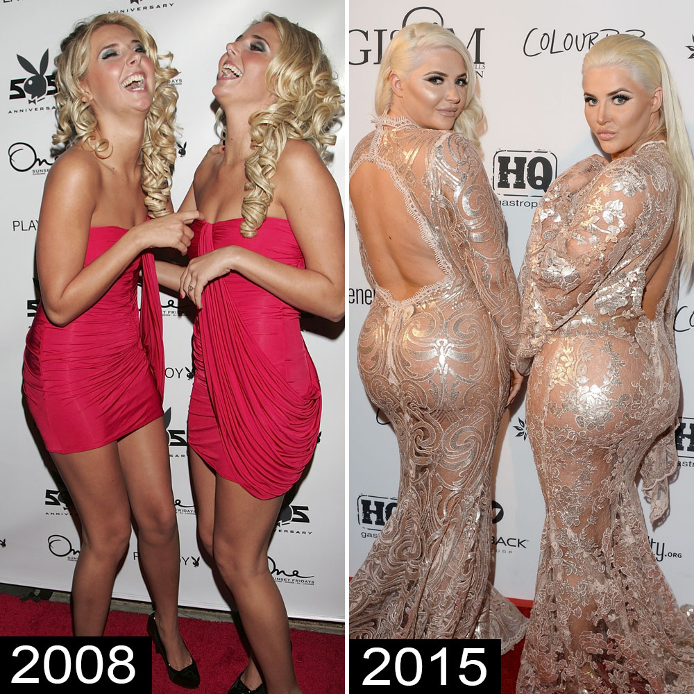 Before-and-After Pics of Celebrities With Rumored Butt Implants