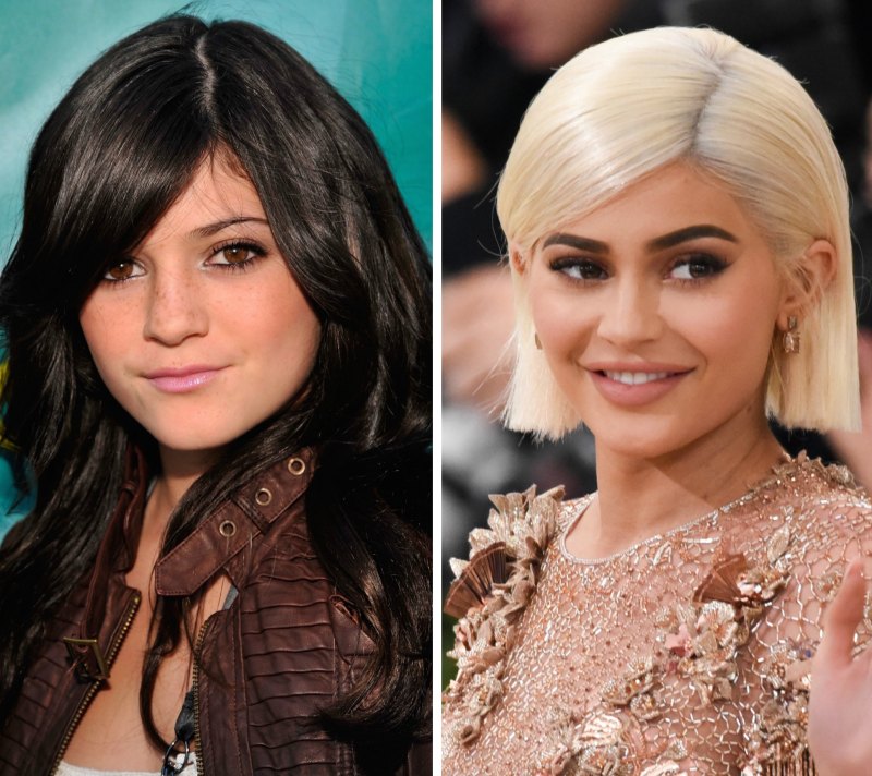 Kylie jenner before and after plastic surgery