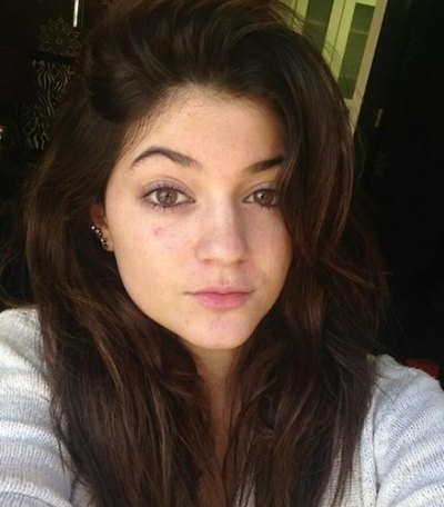kylie freckles younger kylie freckles younger