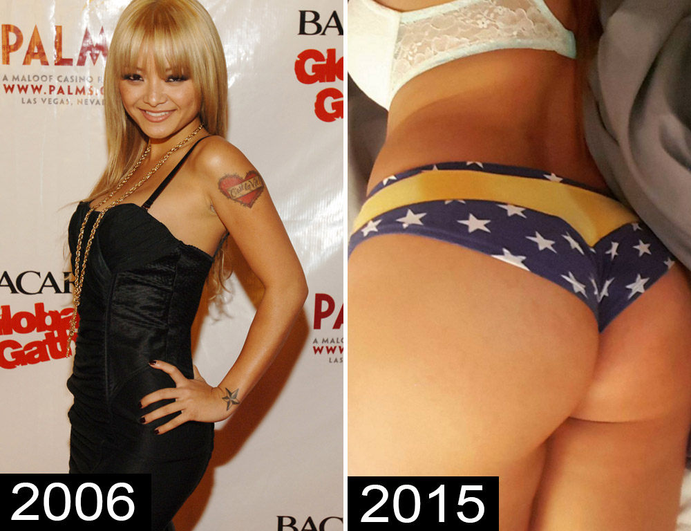 Before-and-After Pics of Celebrities With Rumored Butt Implants image