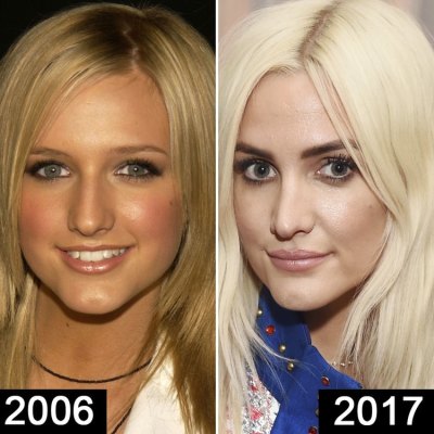 400px x 400px - Did Ashlee Simpson Get More Plastic Surgery? Experts Say Yes!
