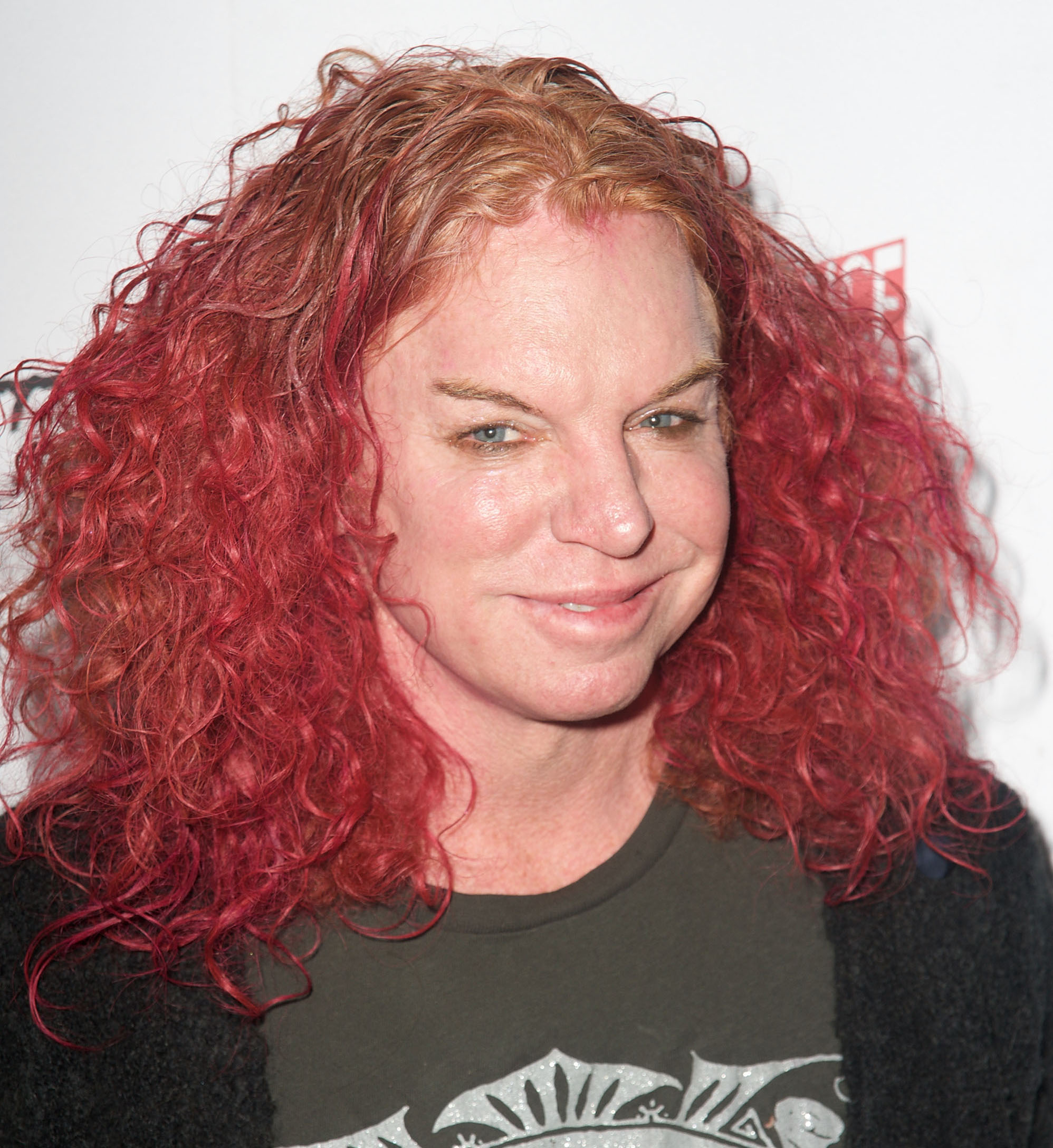 Carrot top botox