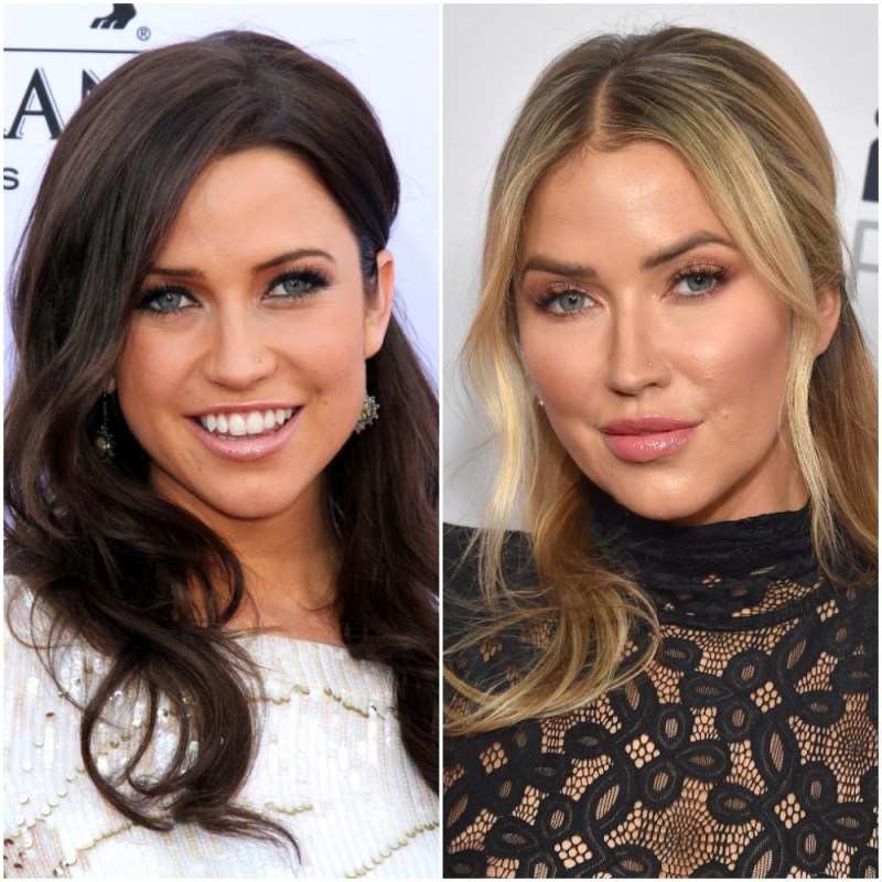 Has Kaitlyn Bristowe Gotten Plastic Surgery? Before, After