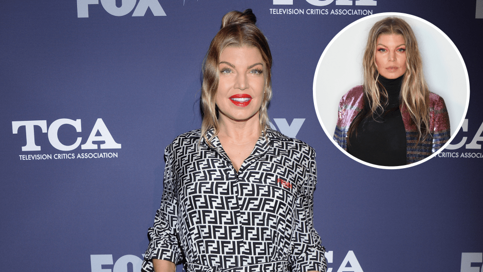 Did Fergie Get Plastic Surgery? Transformation Photos Then and Now