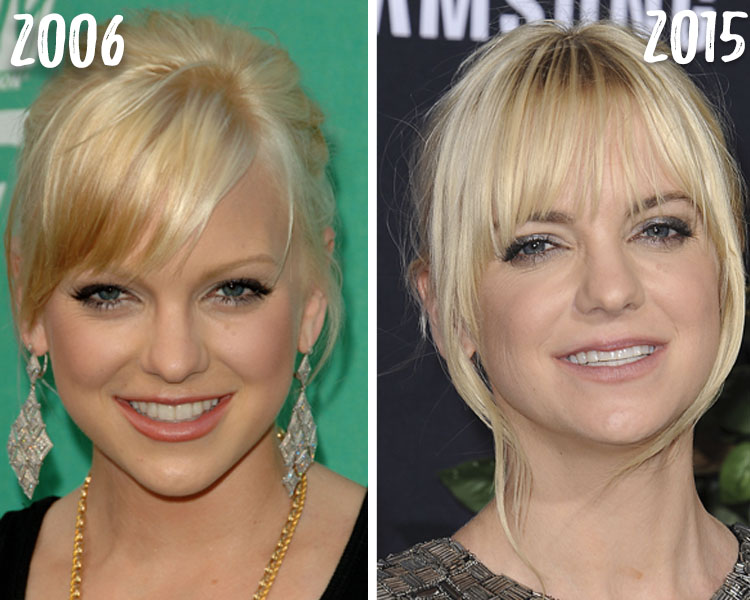 Anna Faris Look Alike Porn - Anna Faris Plastic Surgery: See How the Actress Has Transformed