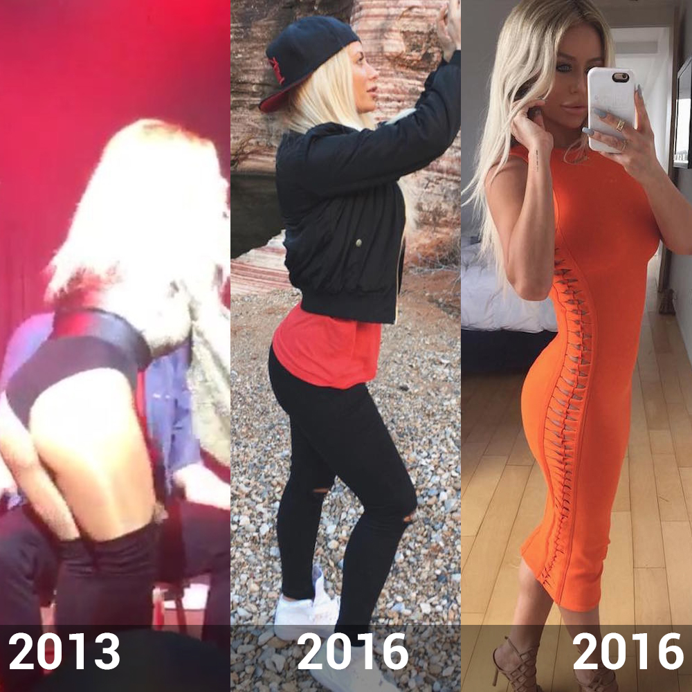 Aubrey oday before plastic surgery butt 2