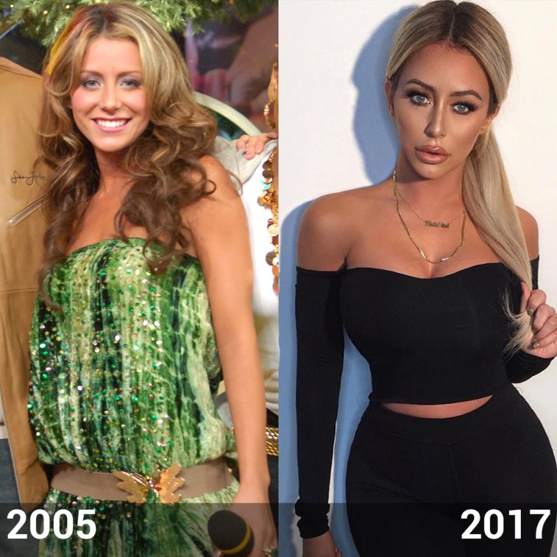 Aubrey oday before plastic surgery end